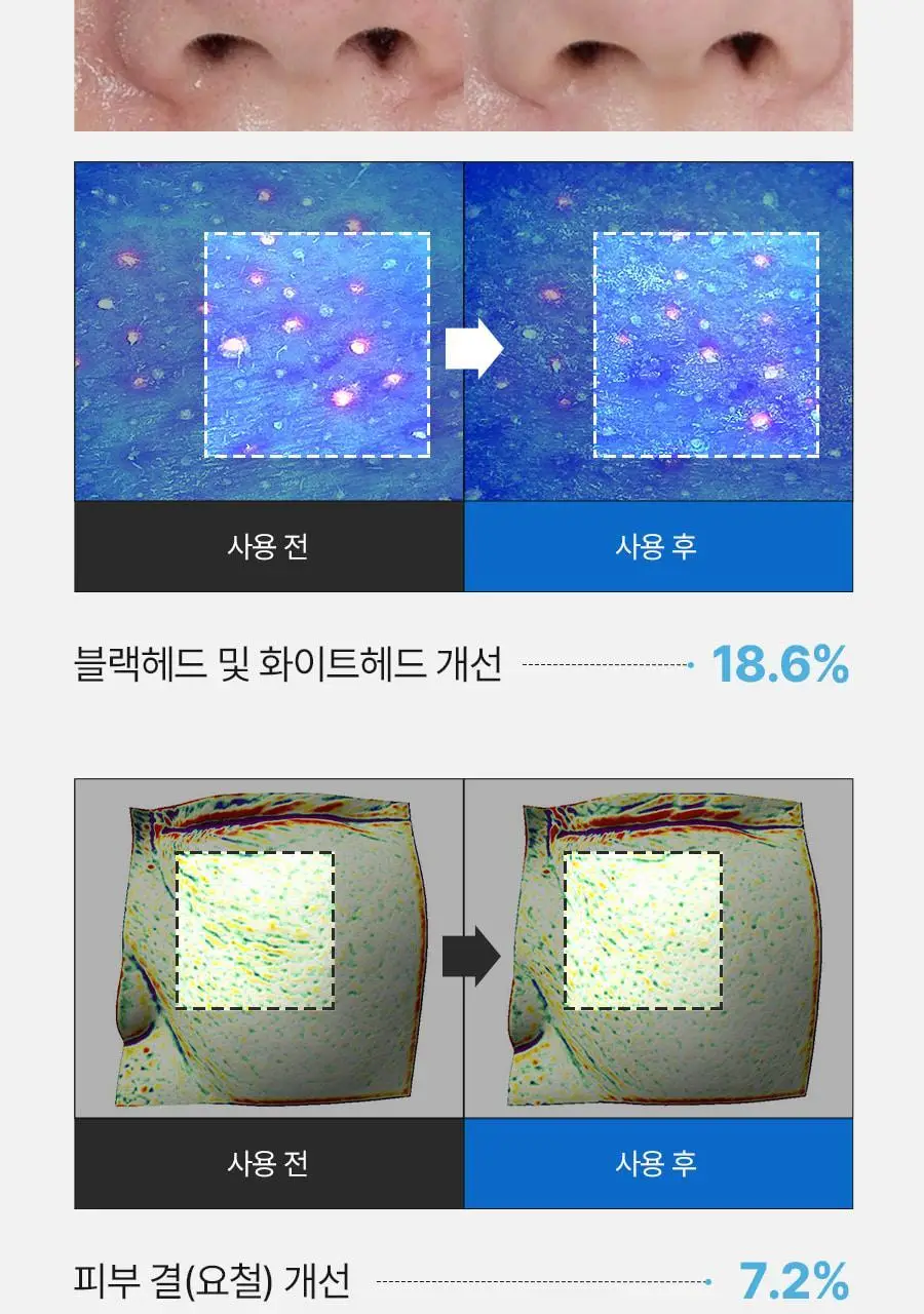 [블랙헤드제거] 메디필 엑스트라 슈퍼9 액티브 스틱 상세페이지 25